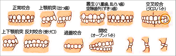 小児歯科 親里小児歯科医院