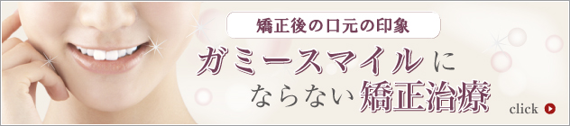 矯正治療後のガミースマイルとは？