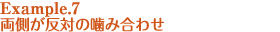 example7両側が反対の噛み合せ