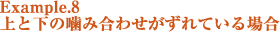 example8上と下の噛み合せがずれている場合